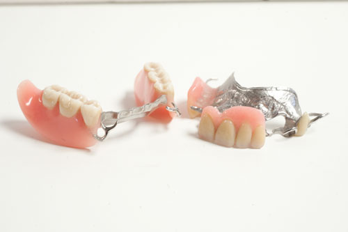 Quels sont les différents types de prothèses dentaires? - Francis Migneault d.d.