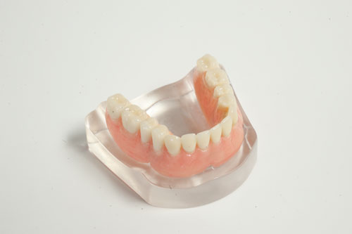 Quels sont les différents types de prothèses dentaires? - Francis Migneault d.d.