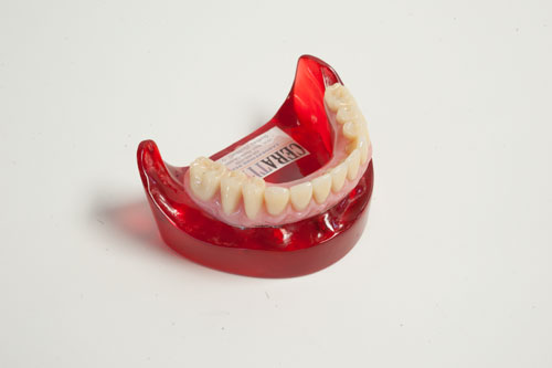 Quels sont les différents types de prothèses dentaires? - Francis Migneault d.d.